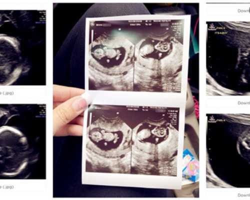 国内供卵医院在哪,2025青岛妇幼剖腹产费用是多少 青岛妇幼剖腹产报销后能花多少钱